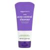 imageAmazon Basics Acne Cleanser Face Wash  Daily Control Maximum Strength 10 Benzoyl Peroxide 5 Ounce Pack of 35 Ounce Pack of 3