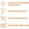 imageAmazon Basics Salicylic Acid Acne Wash 6 Fl Oz Pack of 1